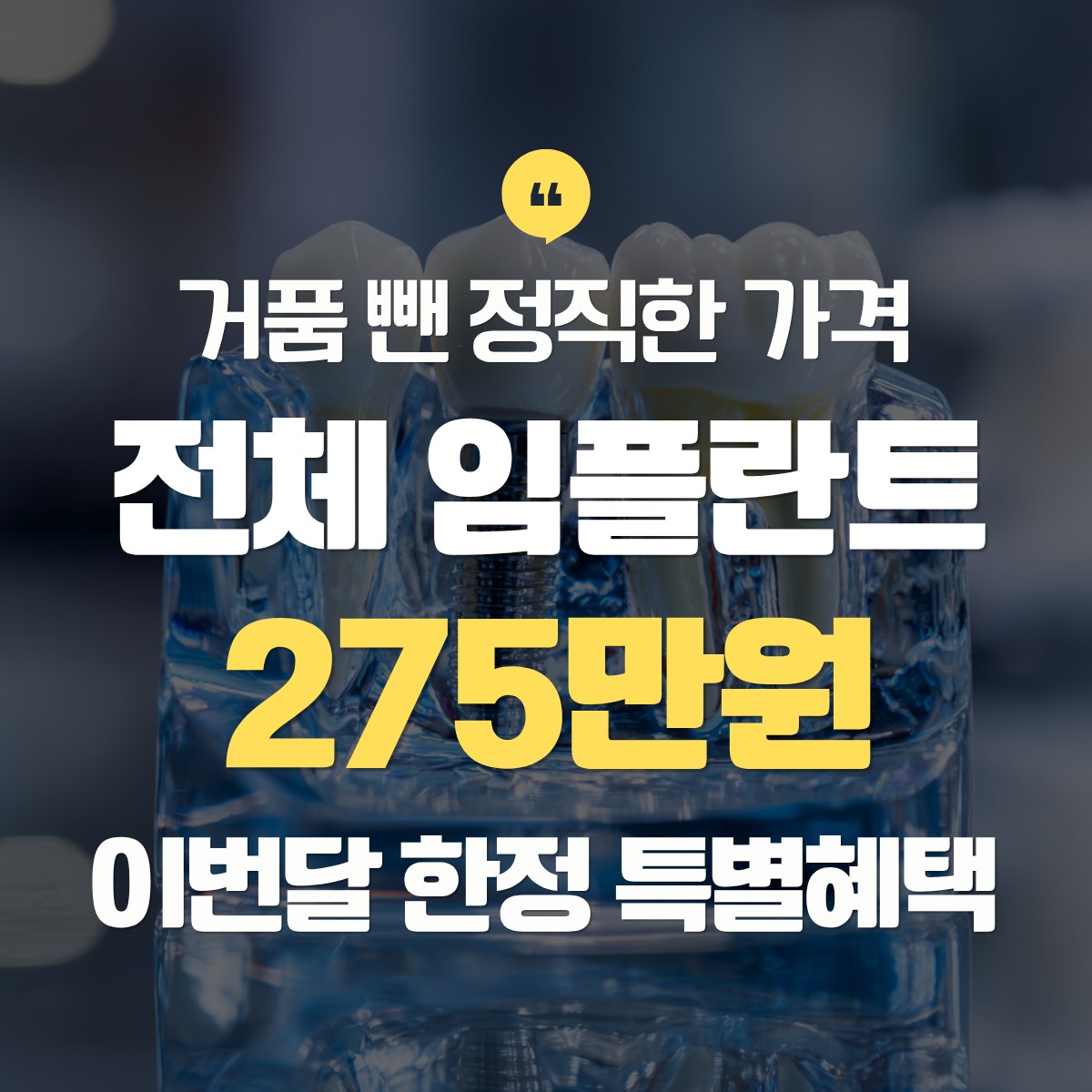 성북구 전체 임플란트 275만원 추천