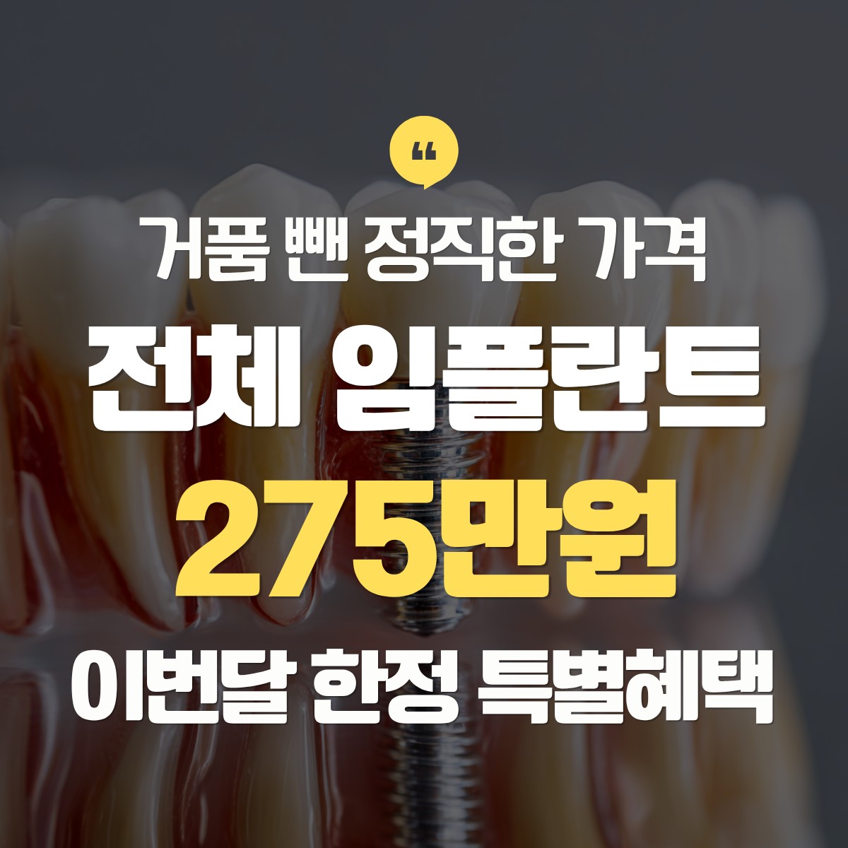 화성 전체 임플란트 275만원 추천
