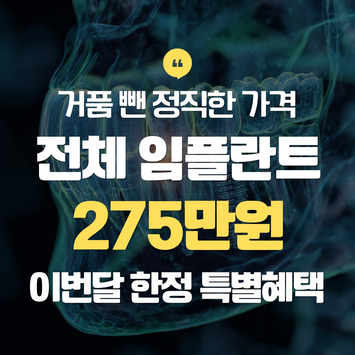 강남구 전체 임플란트 275만원 추천