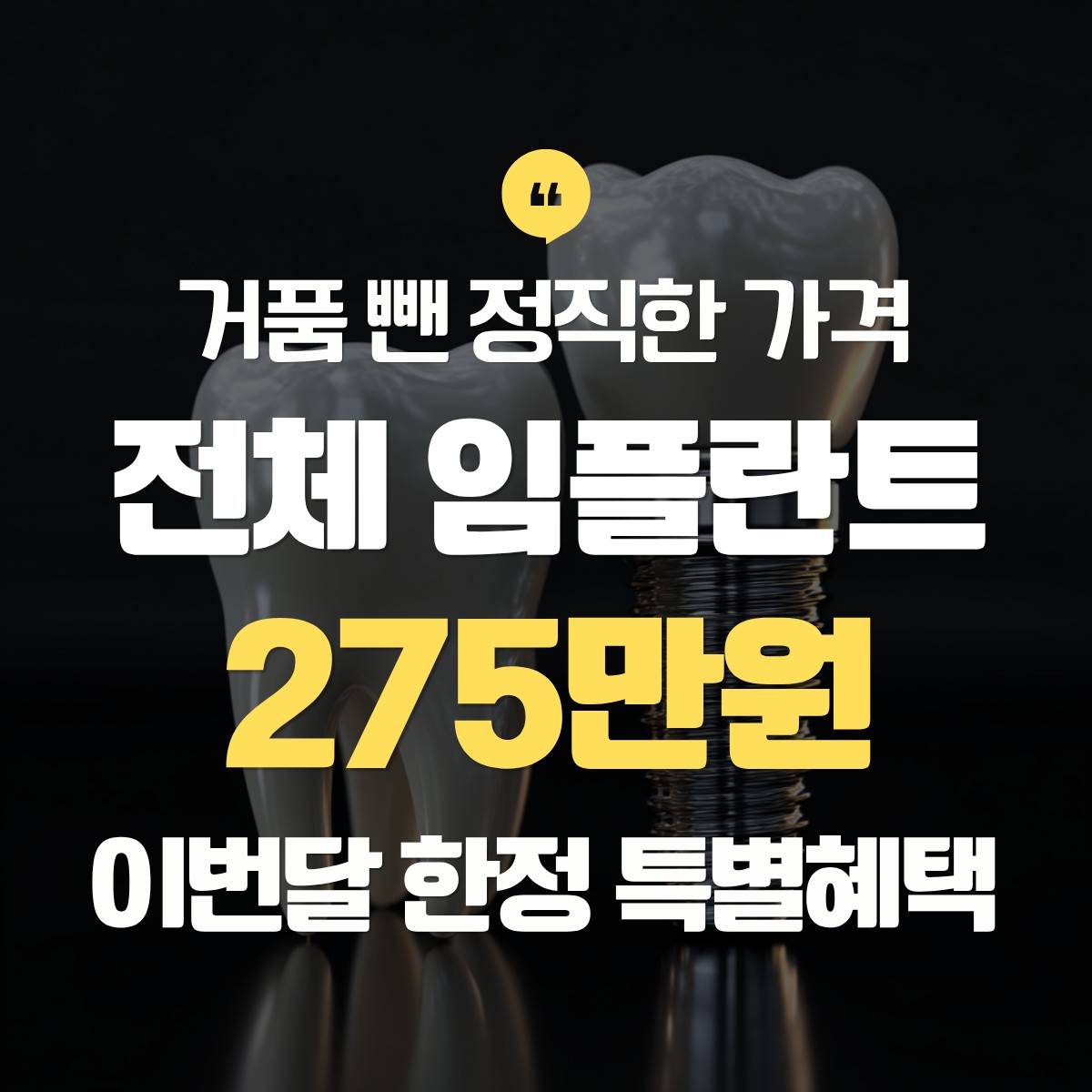부천 전체 임플란트 275만원 추천